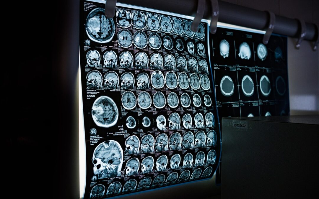 Neuralink